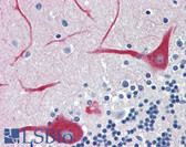 Anti-ATP2A3 / SERCA3 Antibody (clone 2H3) IHC-plus LS-B6010