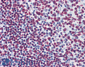 Anti-BIK Antibody (clone 4G12) IHC-plus LS-B6011