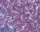 Anti-CAMK4 Antibody (clone 1A3) IHC-plus LS-B6013