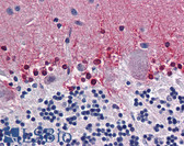 Anti-CBS Antibody (clone 6B8) IHC-plus LS-B6017