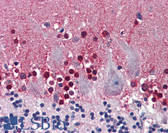 Anti-CBS Antibody (clone 6A9) IHC-plus LS-B6018