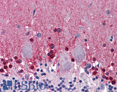 Anti-CBS Antibody (clone 5F7) IHC-plus LS-B6019
