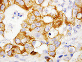 TNFR2 IHC Antibody