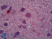 Anti-OLIG2 Antibody (clone 3C9) IHC-plus LS-B6029
