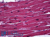 Anti-BCL11A Antibody (clone 3D9) IHC-plus LS-B6033