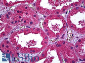 Anti-ERBB3 / HER3 Antibody (clone 3F12) IHC-plus LS-B6036