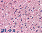 Anti-Tropomyosin Antibody IHC-plus LS-B6045