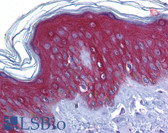 Anti-JUP/CTNNG/Junction Plakoglobin Antibody (aa696-745) IHC-plus LS-B6046