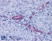 Anti-PTGER2 / EP2 Antibody (aa261-310) IHC-plus LS-B6048