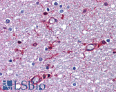 Anti-APP / Beta Amyloid Precursor Antibody (aa737-751) IHC-plus LS-B6051