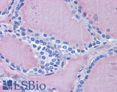 Anti-TG / Thyroglobulin Antibody IHC-plus LS-B6055