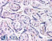 Anti-DUSP16 / MKP7 Antibody (N-Terminus) IHC-plus LS-B1