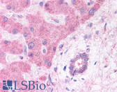 Anti-LRP6 Antibody (Internal) IHC-plus LS-B5