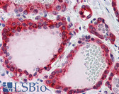 Anti-CTSD / Cathepsin D Antibody (clone 3F12-1B9) IHC-plus LS-B6075