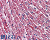 Anti-DLD / Diaphorase / E3 Antibody (clone 2D4) IHC-plus LS-B6078