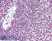 Anti-EP300 / p300 Antibody (clone 1B1) IHC-plus LS-B6080