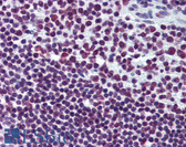 Anti-EWSR1 / EWS Antibody (clone 5C10) IHC-plus LS-B6082