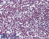 Anti-FOXO3 / FOXO3A Antibody (clone 2H2) IHC-plus LS-B6085