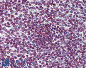 Anti-FOXO3 / FOXO3A Antibody (clone 4F2) IHC-plus LS-B6087