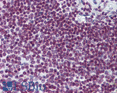 Anti-FOXO3 / FOXO3A Antibody (clone 2C5) IHC-plus LS-B6088