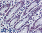 Anti-HDAC1 Antibody (clone 1D6) IHC-plus LS-B6095