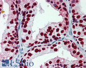 Anti-FOXA1 Antibody (clone 2D7) IHC-plus LS-B6099