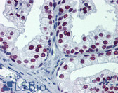 Anti-FOXA1 Antibody (clone 1B1) IHC-plus LS-B6100