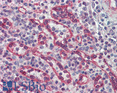 Anti-IRAK2 / IRAK-2 Antibody (clone 6C7) IHC-plus LS-B6102