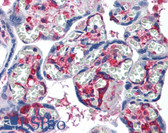 Anti-NME1 Antibody (clone 1D7) IHC-plus LS-B6104