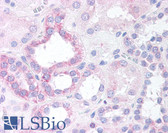 Anti-NOXO1 Antibody (C-Terminus) IHC-plus LS-B3