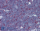 Anti-LIG1 / DNA Ligase 1 Antibody (clone 10G12) IHC-plus LS-B6111