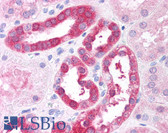 Anti-RICTOR Antibody (C-Terminus) IHC-plus LS-B7