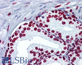 Anti-Histone H4 Antibody (Acetyl-Lys5) IHC-plus LS-B6121