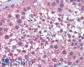 Anti-FAK / Focal Adhesion Kinase Antibody (phospho-Tyr576/Tyr577, clone EP1832Y) IHC-plus LS-B6128