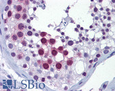 Anti-CDK1 / CDC2 Antibody (phospho-Thr14/Tyr15) IHC-plus LS-B6130