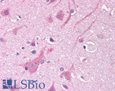Anti-SCN5A / Nav1.5 Antibody (Internal) IHC-plus LS-B8