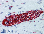 Anti-Peripherin Antibody (clone 3B3) IHC-plus LS-B6138