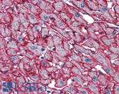 Anti-PSMB4 Antibody (clone 6G7-E8) IHC-plus LS-B6139