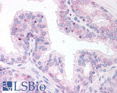 Anti-ERG Antibody (C-Terminus) IHC-plus LS-B9