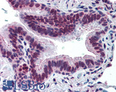 Anti-MUC13 Antibody (Extracellular Domain) IHC-plus LS-A8191