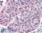 Anti-SLC39A14 / ZIP14 Antibody (Internal) IHC-plus LS-A8196