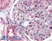 Anti-SLC39A14 / ZIP14 Antibody (Cytoplasmic Domain) IHC-plus LS-A8201