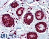 Anti-HELO1 / ELOVL5 Antibody (N-Terminus) IHC-plus LS-A8395