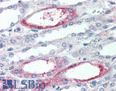 Anti-PIGR Antibody (Extracellular Domain) IHC-plus LS-A8426