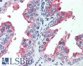 Anti-CDCP1 Antibody (Extracellular Domain) IHC-plus LS-A8447
