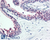 Anti-STEAP2 Antibody (C-Terminus) IHC-plus LS-A9242