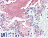 Anti-SLITRK6 Antibody (Cytoplasmic Domain) IHC-plus LS-A9250