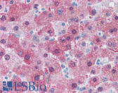 Anti-GCNT3 Antibody (Internal) IHC-plus LS-A9372