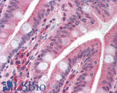 Anti-CDHR5 / MUCDHL Antibody (Cytoplasmic Domain) IHC-plus LS-A9541