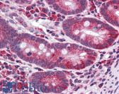 Anti-CDHR5 / MUCDHL Antibody (Cytoplasmic Domain) IHC-plus LS-A9542